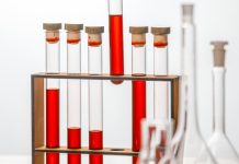 Virtual Cardiac Rehab: A Game-Changer for Heart Health Management